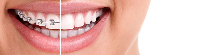 orthodontiki